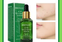 Review Serum Breylee Acne – Berkesan Untuk Jerawat Batu?