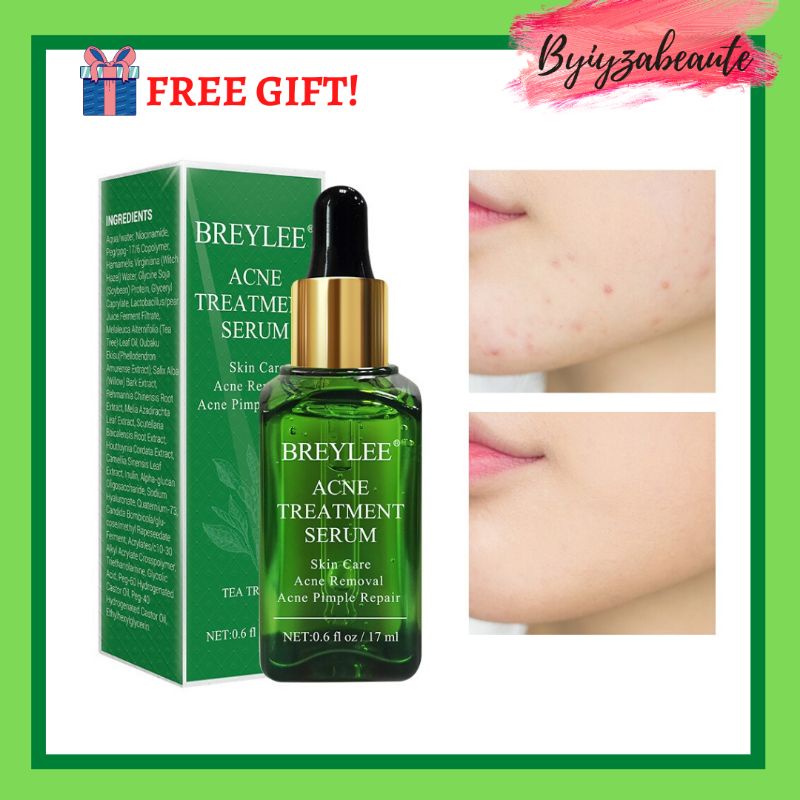 Review Serum Breylee Acne – Berkesan Untuk Jerawat Batu?